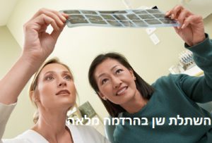 השתלת שן בהרדמה מלאה